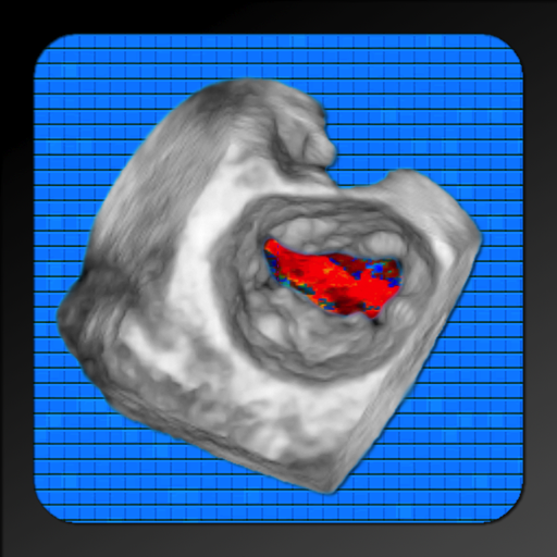 CARDIO3® Atlas of 3D Echocardiography