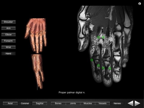 Monster Anatomy - Upper Limbのおすすめ画像1