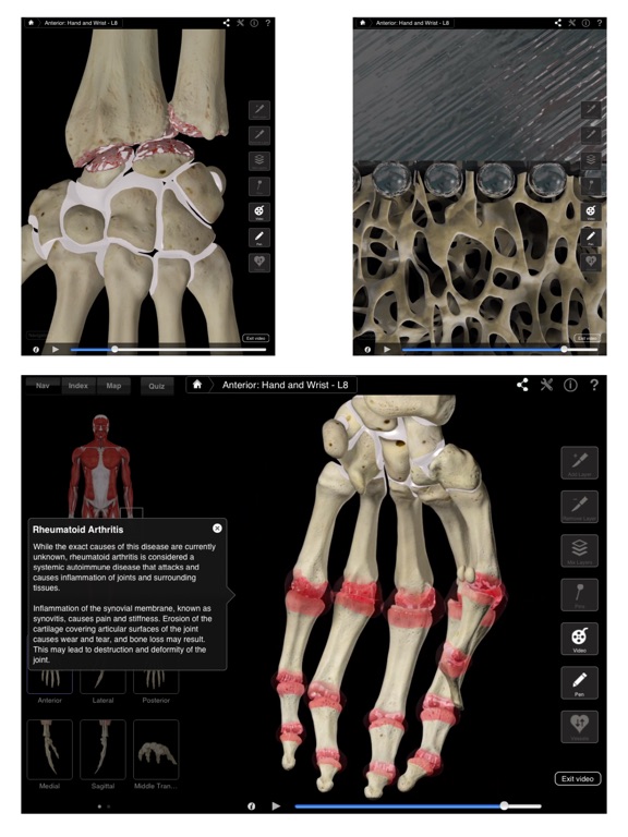 Hand Wrist Pro III - iPad Screenshots