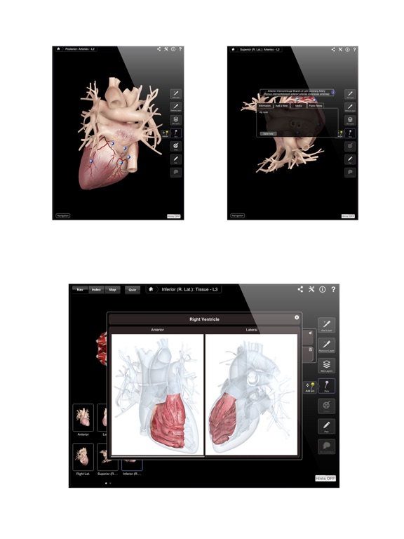 Heart Pro III Screenshots