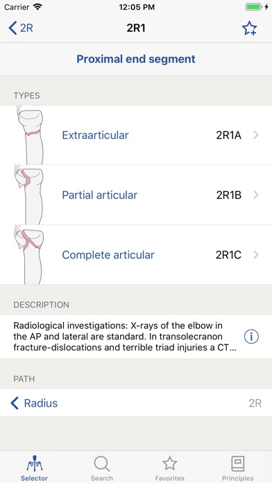 AO/OTA Fracture Classification IPhone App