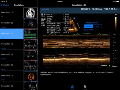 iPad Screenshot 3