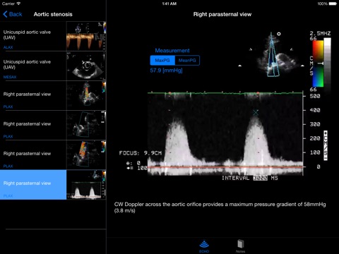iPad Screenshot 2