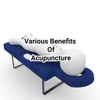 Benefits Of Acupuncture Health & Fitness